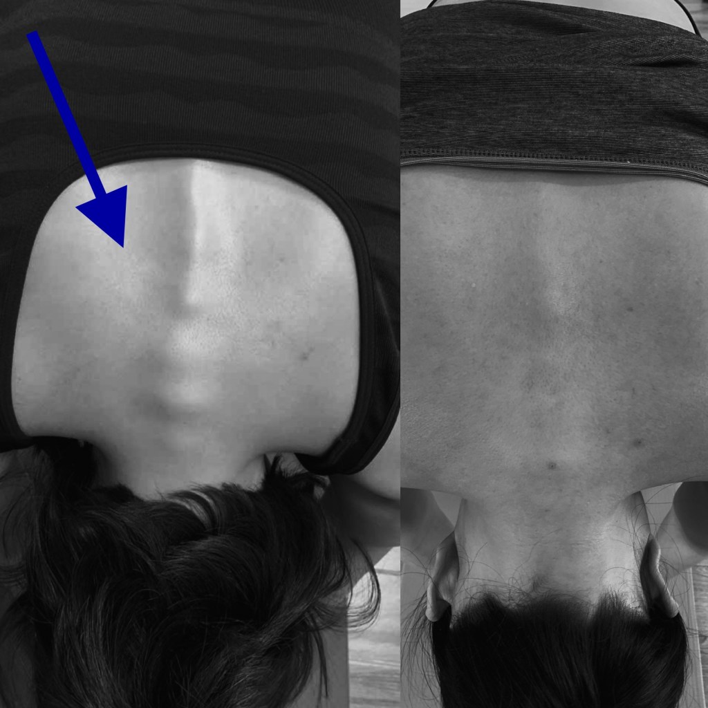 Considerations in Persistent Discomfort