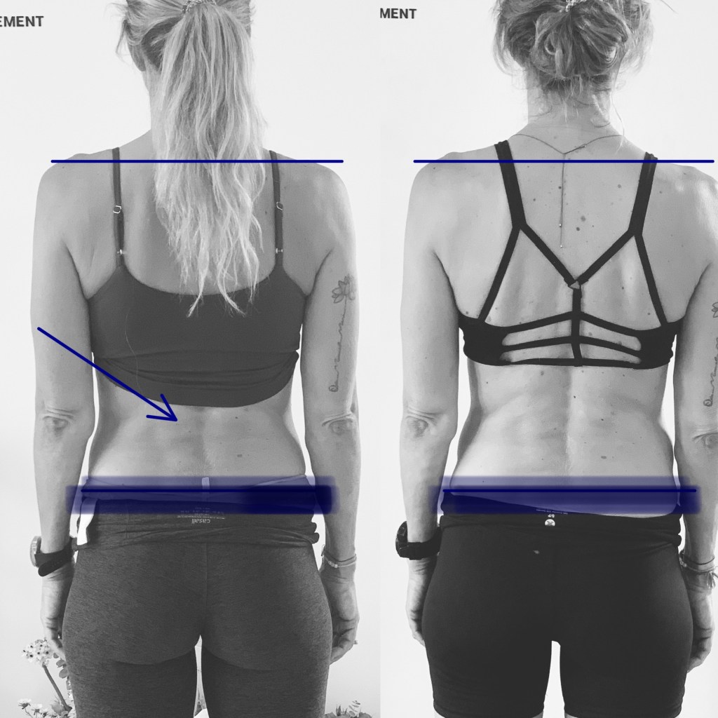 Protection, and Spinal Adaptation